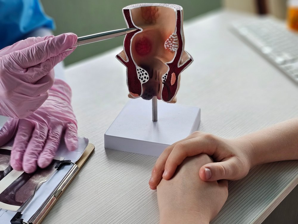 Problemas Anorrectales